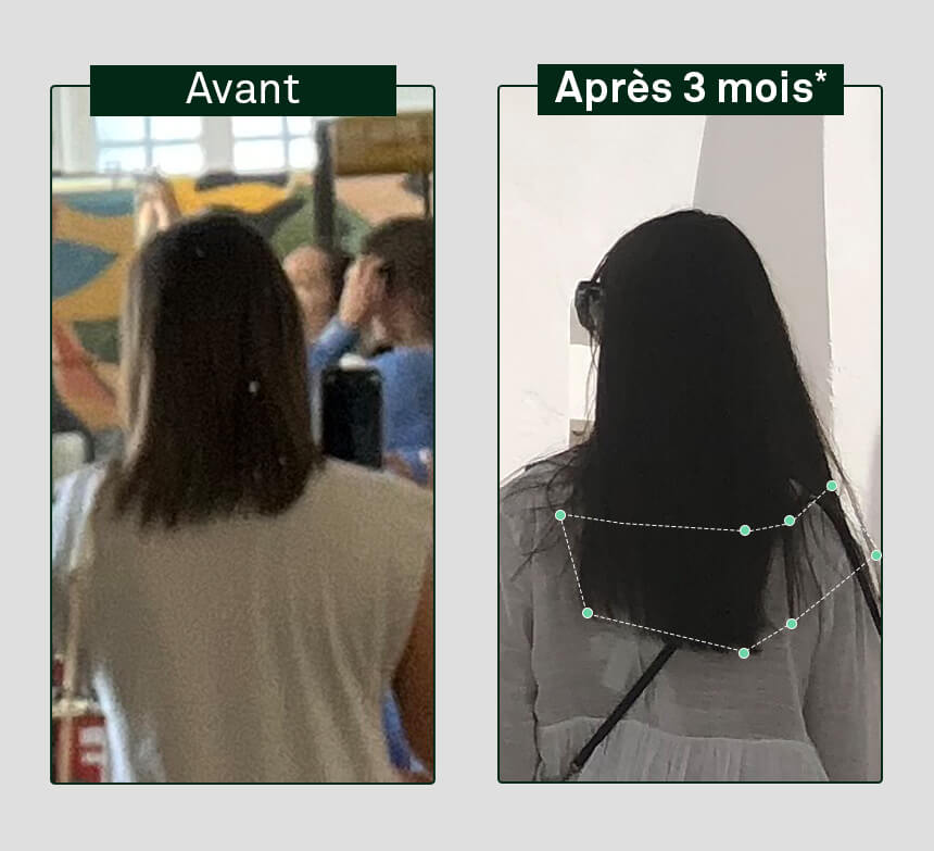 image avant/après