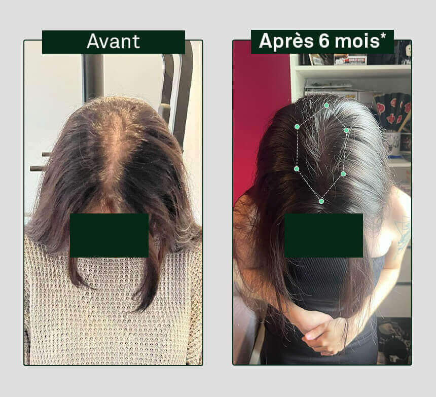 scheut-groei-versterking-x3