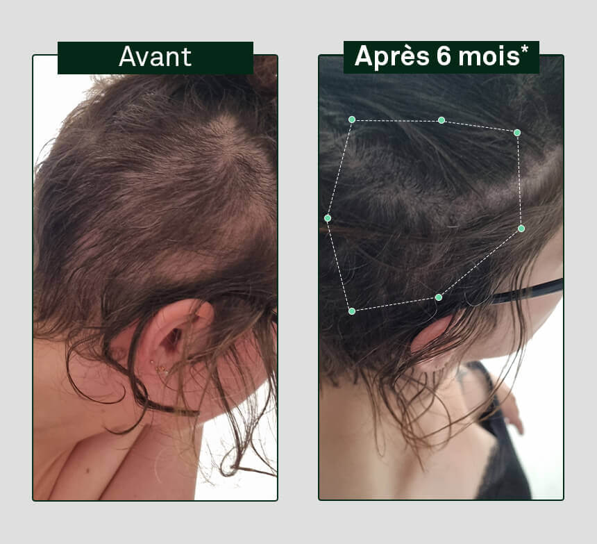 shampoo-groeier